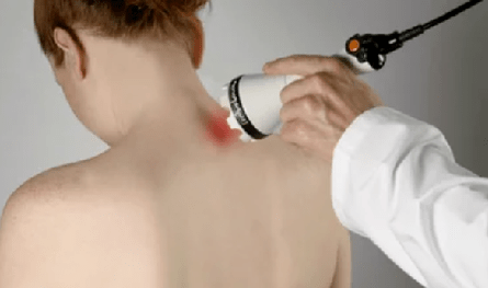 Traitement de l'ostéochondrose cervicale avec des méthodes physiothérapeutiques