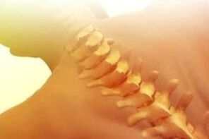 Ostéochondrose, comment traiter